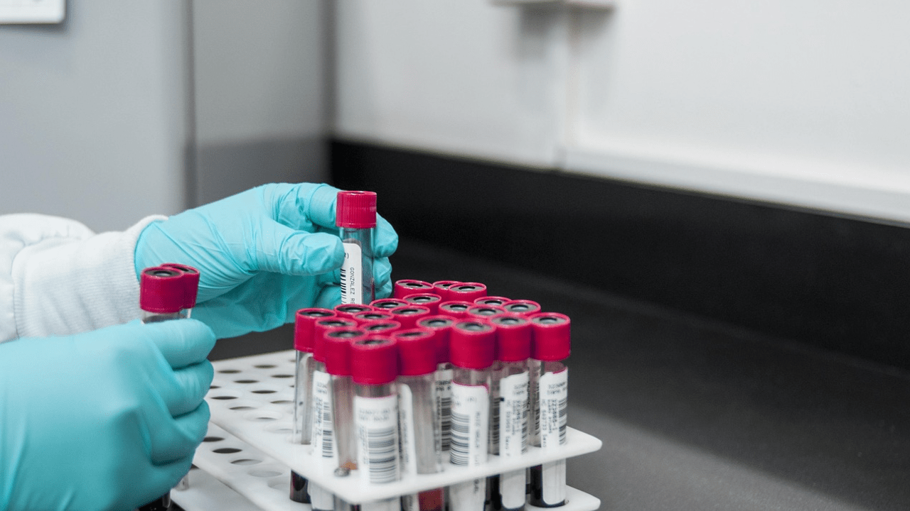 Методы диагностики in vitro Москва МЕДРЕЛИС